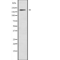 MYO1F Antibody - Western blot analysis of MYO1F expression in A673 lysate. The lane on the left is treated with the antigen-specific peptide.