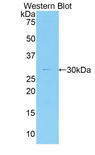 MYO1G / HA2 Antibody - Western blot of recombinant MYO1G / HA2.  This image was taken for the unconjugated form of this product. Other forms have not been tested.