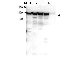 MYO1G / HA2 Antibody - Anti-Myosin 1G Antibody - Western Blot. Western blot of affinity purified anti-Myosin 1G antibody shows detection of a band ~100 kD in size corresponding to Myosin 1G (arrowhead) in Myosin 1G positive whole cell lysate - lane 1 Jurkat, lane 2 peripheral blood T cells, lane 3 human spleen and lane 4 300.19. Lane 5, 293 cells, appear negative for Myosin 1G. Personal Communication. Stephen Shaw, NCI, Bethesda, MD.