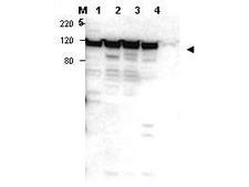 MYO1G / HA2 Antibody - Anti-Myosin 1G Antibody - Western Blot. Western blot of affinity purified anti-Myosin 1G antibody shows detection of a band ~100 kD in size corresponding to Myosin 1G (arrowhead) in Myosin 1G positive whole cell lysate - lane 1 Jurkat, lane 2 peripheral blood T cells, lane 3 human spleen and lane 4 300.19. Lane 5, 293 cells, appear negative for Myosin 1G. Personal Communication. Stephen Shaw, NCI, Bethesda, MD.