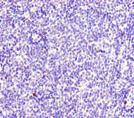 MYO1G / HA2 Antibody - Immunohistochemistry of paraffin-embedded human lymphoid tissue at dilution of 1:100