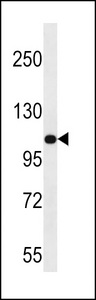 MYO3B Antibody - MYO3B Antibody western blot of uterus tumor cell line lysates (35 ug/lane). The MYO3B antibody detected the MYO3B protein (arrow).