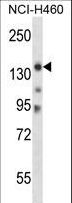 MYO3B Antibody - Mouse Myo3b Antibody western blot of NCI-H460 cell line lysates (35 ug/lane). The Myo3b antibody detected the Myo3b protein (arrow).