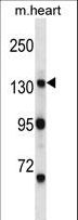 MYO3B Antibody - Mouse Myo3b Antibody western blot of mouse heart tissue lysates (35 ug/lane). The Myo3b antibody detected the Myo3b protein (arrow).