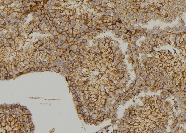 MYO3B Antibody - 1:100 staining testis tissue by IHC-P. The sample was formaldehyde fixed and a heat mediated antigen retrieval step in citrate buffer was performed. The sample was then blocked and incubated with the antibody for 1.5 hours at 22°C. An HRP conjugated goat anti-rabbit antibody was used as the secondary.