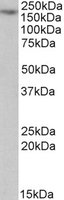 MYO5A / Myosin V Antibody - MYO5A antibody (1 ug/ml) staining of Jurkat lysate (35 ug protein/ml in RIPA buffer). Primary incubation was 1 hour. Detected by chemiluminescence.
