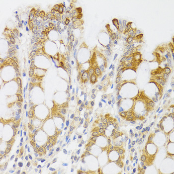 MYO5A / Myosin V Antibody - Immunohistochemistry of paraffin-embedded human rectum tissue.