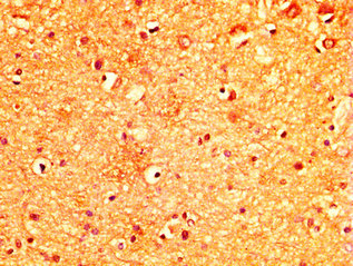 MYO5A / Myosin V Antibody - Immunohistochemistry image at a dilution of 1:300 and staining in paraffin-embedded human brain tissue performed on a Leica BondTM system. After dewaxing and hydration, antigen retrieval was mediated by high pressure in a citrate buffer (pH 6.0) . Section was blocked with 10% normal goat serum 30min at RT. Then primary antibody (1% BSA) was incubated at 4 °C overnight. The primary is detected by a biotinylated secondary antibody and visualized using an HRP conjugated SP system.