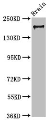 MYO5A / Myosin V Antibody - Positive Western Blot detected in Mouse brain tissue. All lanes: MYO5A antibody at 7.3 µg/ml Secondary Goat polyclonal to rabbit IgG at 1/50000 dilution. Predicted band size: 216, 213, 219 KDa. Observed band size: 216 KDa