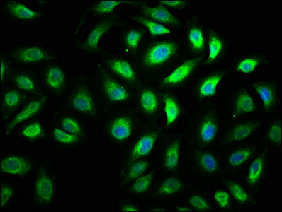 MYO5A / Myosin V Antibody - Immunofluorescence staining of A549 cells with MYO5A Antibody at 1:100, counter-stained with DAPI. The cells were fixed in 4% formaldehyde, permeabilized using 0.2% Triton X-100 and blocked in 10% normal Goat Serum. The cells were then incubated with the antibody overnight at 4°C. The secondary antibody was Alexa Fluor 488-congugated AffiniPure Goat Anti-Rabbit IgG(H+L).