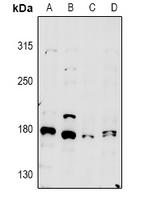 MYO5A / Myosin V Antibody - Western blot analysis of MYO5A expression in H9C2 (A), AML12 (B), A2780 (C), HepG2 (D) whole cell lysates.