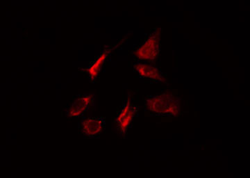 MYO5A / Myosin V Antibody - Staining HeLa cells by IF/ICC. The samples were fixed with PFA and permeabilized in 0.1% Triton X-100, then blocked in 10% serum for 45 min at 25°C. The primary antibody was diluted at 1:200 and incubated with the sample for 1 hour at 37°C. An Alexa Fluor 594 conjugated goat anti-rabbit IgG (H+L) antibody, diluted at 1/600, was used as secondary antibody.