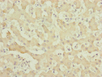 MYO5B / Myosin VB Antibody - Immunohistochemistry of paraffin-embedded human liver tissue at dilution of 1:100