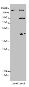 MYO5B / Myosin VB Antibody - Western blot All Lanes:MYO5B antibody at 1.7 ug/ml Lane 1: Jurkat whole cell lysate Lane 2: HepG-2 whole cell lysate Secondary Goat polyclonal to rabbit IgG at 1/10000 dilution Predicted band size: 214,112,48 kDa Observed band size: 214,95,45 kDa