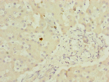 MYO5B / Myosin VB Antibody - Immunohistochemistry of paraffin-embedded human liver tissue at dilution of 1:100