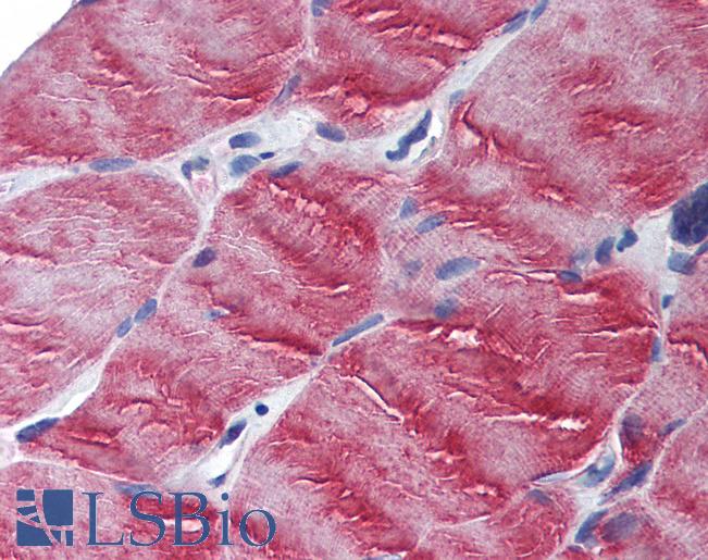 MYO5B / Myosin VB Antibody - Anti-MYO5B antibody IHC of human skeletal muscle. Immunohistochemistry of formalin-fixed, paraffin-embedded tissue after heat-induced antigen retrieval. Antibody concentration 5 ug/ml.