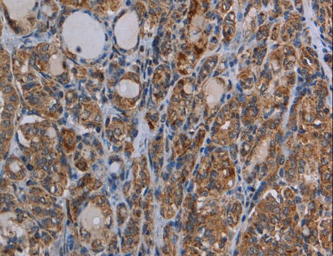 MYO7A / Myosin-VIIa Antibody - Immunohistochemistry of paraffin-embedded Human brain using MYO7A Polyclonal Antibody at dilution of 1:30.