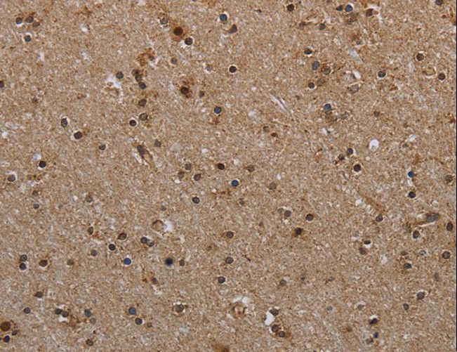 MYO7A / Myosin-VIIa Antibody - Immunohistochemistry of paraffin-embedded Human brain using MYO7A Polyclonal Antibody at dilution of 1:30.