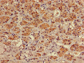 MYO7A / Myosin-VIIa Antibody - Immunohistochemistry of paraffin-embedded human adrenal gland tissue using MYO7A Antibody at dilution of 1:100