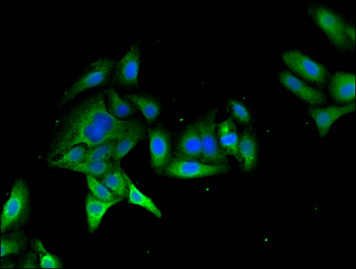 MYO7A / Myosin-VIIa Antibody - Immunofluorescent analysis of HepG2 cells using MYO7A Antibody at a dilution of 1:100 and Alexa Fluor 488-congugated AffiniPure Goat Anti-Rabbit IgG(H+L)