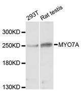 MYO7A / Myosin-VIIa Antibody - Western blot analysis of extracts of various cell lines, using MYO7A antibody at 1:3000 dilution. The secondary antibody used was an HRP Goat Anti-Rabbit IgG (H+L) at 1:10000 dilution. Lysates were loaded 25ug per lane and 3% nonfat dry milk in TBST was used for blocking. An ECL Kit was used for detection and the exposure time was 30s.