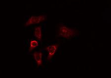 MYO9B Antibody - Staining HeLa cells by IF/ICC. The samples were fixed with PFA and permeabilized in 0.1% Triton X-100, then blocked in 10% serum for 45 min at 25°C. The primary antibody was diluted at 1:200 and incubated with the sample for 1 hour at 37°C. An Alexa Fluor 594 conjugated goat anti-rabbit IgG (H+L) antibody, diluted at 1/600, was used as secondary antibody.