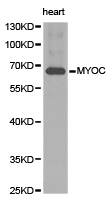 MYOC / Myocilin Antibody - Western blot of extracts of human heart tissue, using MYOC antibody.