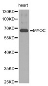 MYOC / Myocilin Antibody - Western blot analysis of extracts of human heart tissue, using MYOC antibody.