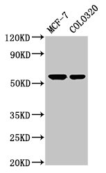MYOC / Myocilin Antibody - Positive Western Blot detected in MCF-7 whole cell lysate, COLO320 whole cell lysate. All lanes: MYOC antibody at 5.2 µg/ml Secondary Goat polyclonal to rabbit IgG at 1/50000 dilution. Predicted band size: 57 KDa. Observed band size: 57 KDa