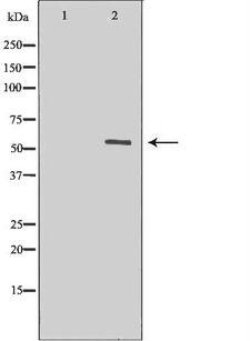 MYOC / Myocilin Antibody - Western blot analysis of extracts of human heart tissue using MYOC antibody. The lane on the left is treated with the antigen-specific peptide.