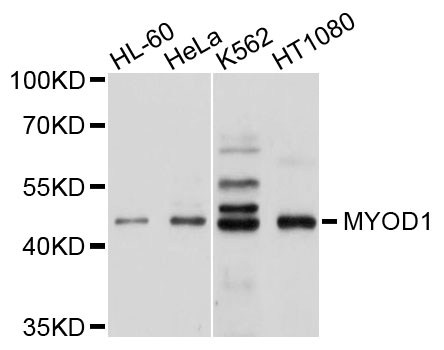 MYOD / MYOD1 Antibody - Western blot analysis of extracts of various cell lines, using MYOD1 antibody at 1:1000 dilution. The secondary antibody used was an HRP Goat Anti-Rabbit IgG (H+L) at 1:10000 dilution. Lysates were loaded 25ug per lane and 3% nonfat dry milk in TBST was used for blocking. An ECL Kit was used for detection and the exposure time was 90s.