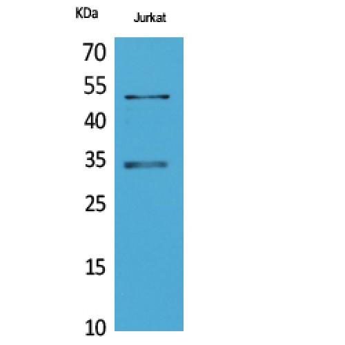 MYOD / MYOD1 Antibody - Western blot of MyoD antibody