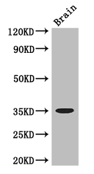 MYOD / MYOD1 Antibody - Positive WB detected in:Mouse brain tissue;All lanes: MYOD1 antibody at 3ug/ml;Secondary;Goat polyclonal to rabbit IgG at 1/50000 dilution;Predicted band size: 35 kDa;Observed band size: 35 kDa;