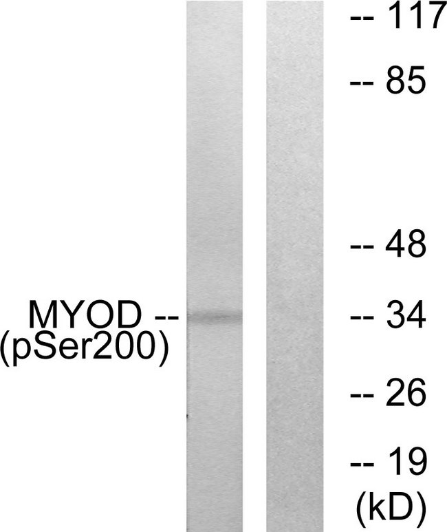 MYOD / MYOD1 Antibody - Western blot analysis of lysates from Jurkat cells treated with Ca+ 40nM 30', using MYOD (Phospho-Ser200) Antibody. The lane on the right is blocked with the phospho peptide.