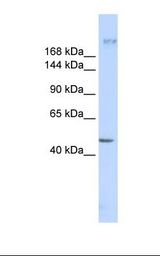 MYOF / Myoferlin Antibody - MCF7 cell lysate. Antibody concentration: 1.0 ug/ml. Gel concentration: 6-18%.  This image was taken for the unconjugated form of this product. Other forms have not been tested.
