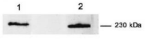 MYOF / Myoferlin Antibody - Detection of myoferlin in (1) C2C12 cell lysate and (2) human fibroblast cell lysate with Myoferlin Monoclonal Antibody.