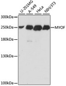 MYOF / Myoferlin Antibody - Western blot analysis of extracts of various cell lines, using MYOF antibody at 1:1000 dilution. The secondary antibody used was an HRP Goat Anti-Rabbit IgG (H+L) at 1:10000 dilution. Lysates were loaded 25ug per lane and 3% nonfat dry milk in TBST was used for blocking. An ECL Kit was used for detection and the exposure time was 2s.