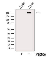 MYOF / Myoferlin Antibody - Western blot analysis of extracts of A549 cells using Myoferlin antibody. The lane on the left was treated with blocking peptide.