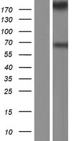 MYOF / Myoferlin Protein - Western validation with an anti-DDK antibody * L: Control HEK293 lysate R: Over-expression lysate