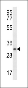 MYOG / Myogenin Antibody - MYOGENIN Antibody western blot of ZR-75-1 cell line lysates (35 ug/lane). The MYOGENIN antibody detected the MYOGENIN protein (arrow).