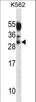 MYOG / Myogenin Antibody - MYOG Antibody western blot of K562 cell line lysates (35 ug/lane). The MYOG antibody detected the MYOG protein (arrow).