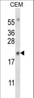 MYOG / Myogenin Antibody - MYOG Antibody western blot of CEM cell line lysates (35 ug/lane). The MYOG antibody detected the MYOG protein (arrow).