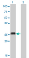 MYOG / Myogenin Antibody - Western Blot analysis of MYOG expression in transfected 293T cell line by MYOG monoclonal antibody (M01), clone 2B7.Lane 1: MYOG transfected lysate(25 KDa).Lane 2: Non-transfected lysate.