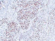 MYOG / Myogenin Antibody - Rhabdomyosarcoma 1