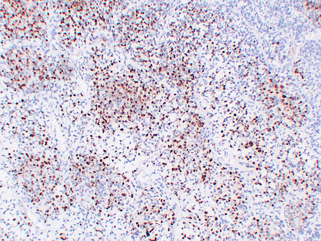 MYOG / Myogenin Antibody - Rhabdomyosarcoma 2