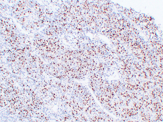 MYOG / Myogenin Antibody - Rhabdomyosarcoma 3