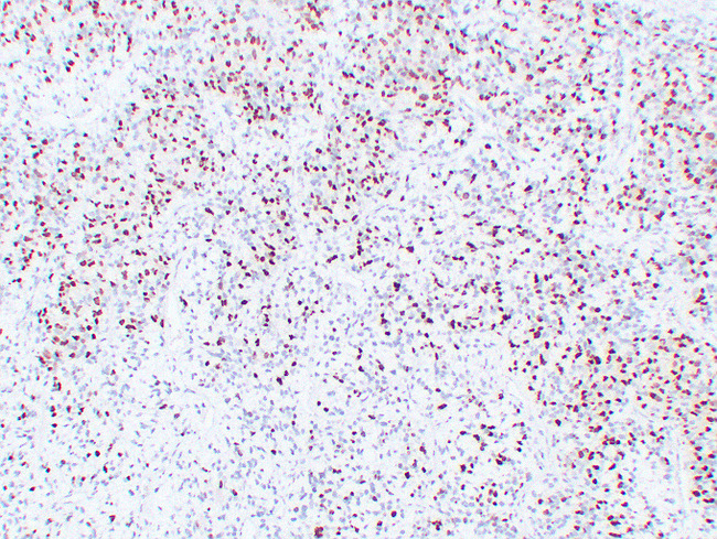 MYOG / Myogenin Antibody - Rhabdomyosarcoma 4