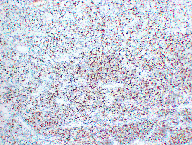 MYOG / Myogenin Antibody - Rhabdomyosarcoma 5