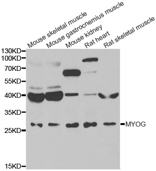 MYOG / Myogenin Antibody - Western blot analysis of extracts of various cell lines, using MYOG antibody.