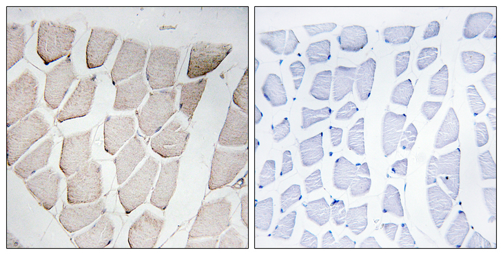 MYOM1 / Myomesin 1 Antibody - Immunohistochemistry analysis of paraffin-embedded human skeletal muscle, using MYOM1 Antibody. The picture on the right is blocked with the synthesized peptide.